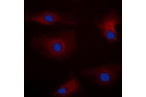 Immunofluorescent analysis of PAK1 staining in HEK293T cells. (PAK1 抗体  (Center))