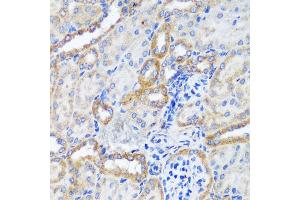 Immunohistochemistry of paraffin-embedded mouse kidney using ERK1 / ERK2 antibody (ABIN7268619) at dilution of 1:200 (40x lens).