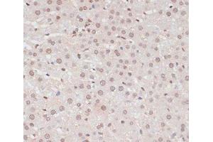 Immunohistochemistry (Paraffin-embedded Sections) (IHC (p)) image for anti-Signal Transducer and Activator of Transcription 1, 91kDa (STAT1) (pSer727) antibody (ABIN7265092)