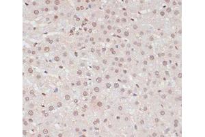 Immunohistochemistry of paraffin-embedded Rat liver using Phospho-STAT1(S727) Polyclonal Antibody at dilution of 1:100 (40x lens).