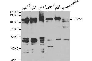 Western blot analysis of extracts of various cell lines, using EEF2K antibody.