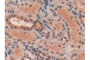 Immunohistochemistry (IHC) image for anti-Frizzled Family Receptor 1 (Fzd1) (AA 117-322) antibody (ABIN7435805)