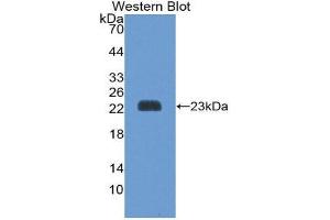 Western Blotting (WB) image for anti-Peroxiredoxin 1 (PRDX1) (AA 1-199) antibody (ABIN3204955) (Peroxiredoxin 1 抗体  (AA 1-199))