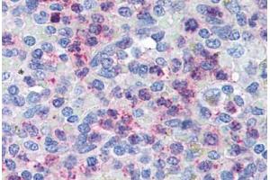 Human Spleen (formalin-fixed, paraffin-embedded) stained with CXCR4 antibody ABIN305765 at 5 ug/ml followed by biotinylated goat anti-rabbit IgG secondary antibody ABIN481713, alkaline phosphatase-streptavidin and chromogen. (CXCR4 抗体  (AA 182-196))