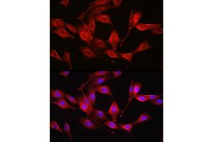 Immunofluorescence analysis of NIH/3T3 cells using [KO Validated] Glutathione Synthetase (GSS) Rabbit pAb (ABIN7267451) at dilution of 1:100 (40x lens). (Glutathione Synthetase 抗体  (AA 373-474))