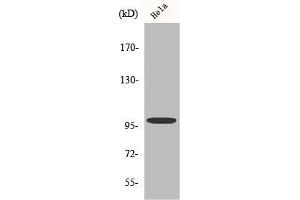 Western Blot analysis of HeLa cells using Catenin-α E/N Polyclonal Antibody (CTNNA2 抗体  (C-Term))