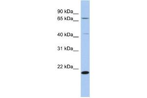 WB Suggested Anti-AMD1 Antibody Titration: 0. (AMD1 抗体  (N-Term))