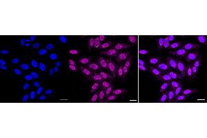 Immunocytochemical staining of HepG2 cells with Histone H2B (formyl K108) antibody (ABIN7798947), 1:1,000). (Recombinant Histone H2B 抗体  (H2BK108fo))