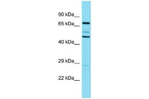 Western Blotting (WB) image for anti-Cortactin (CTTN) (N-Term) antibody (ABIN2774002) (Cortactin 抗体  (N-Term))