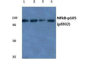 Western blot (WB) analysis of p-NFkB-p105 antibody at 1/500 dilution (NFKB1 抗体  (pSer932))