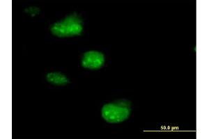 Immunofluorescence of purified MaxPab antibody to SSNA1 on HeLa cell. (SSNA1 抗体  (AA 1-119))