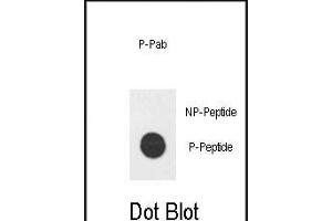 Dot blot analysis of Phospho-hE2F1- Pab (ABIN650836 and ABIN2839802) on nitrocellulose membrane. (E2F1 抗体  (His357))
