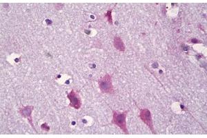 Anti-KCNIP3 / CSEN antibody IHC staining of human brain, cortex neurons. (DREAM 抗体  (AA 29-78))