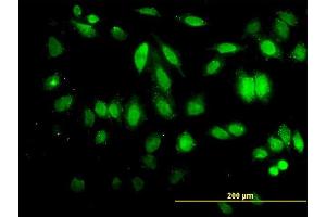Immunofluorescence of monoclonal antibody to HDAC5 on HeLa cell. (HDAC5 抗体  (AA 330-429))