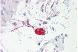 Anti-ADRA2A antibody IHC staining of human colon, submucosal plexus. (ADRA2A 抗体  (AA 331-380))