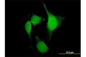 Immunofluorescence of purified MaxPab antibody to PTGS2 on HeLa cell. (PTGS2 抗体  (AA 1-604))