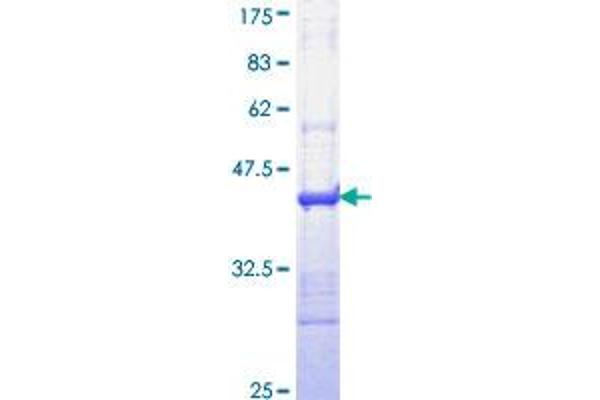IL-24 Protein (AA 58-167) (GST tag)