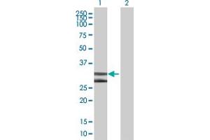 Western Blot analysis of DNALI1 expression in transfected 293T cell line by DNALI1 MaxPab polyclonal antibody. (DNALI1 抗体  (AA 1-258))