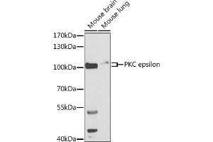 Western blot analysis of extracts of various cell lines, using PKC epsilon antibody (ABIN3022941, ABIN3022942, ABIN3022943 and ABIN6219308) at 1:500 dilution.