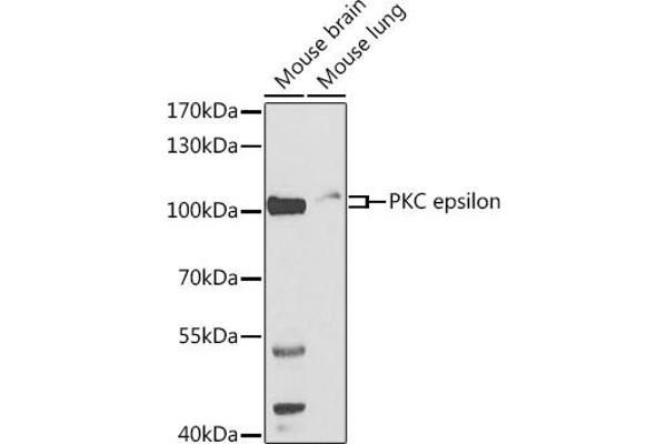 PKC epsilon anticorps  (AA 488-737)