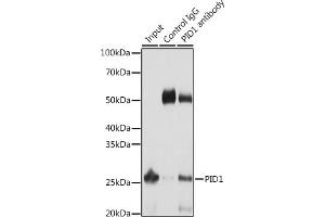 Immunoprecipitation analysis of 25 μg extracts of Mouse liver cells using 3 μg PID1 antibody (ABIN6133302, ABIN6145610, ABIN6145611 and ABIN6217139). (PID1 抗体  (AA 124-248))