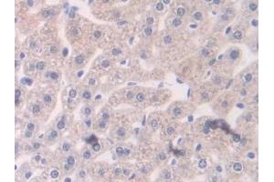 DAB staining on IHC-P; Samples: Mouse Liver Tissue (RALBP1 抗体  (AA 192-380))