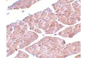 Immunohistochemistry of TRPC3 in mouse heart tissue with TRPC3 polyclonal antibody  at 2 ug/mL . (TRPC3 抗体  (C-Term))