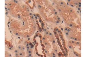 Detection of UCHL1 in Human Kidney Tissue using Polyclonal Antibody to Ubiquitin Carboxyl Terminal Hydrolase L1 (UCHL1) (UCHL1 抗体  (AA 2-223))