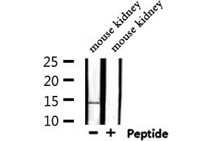 Western blot analysis of extracts from mouse kidney, using MSS4 Antibody. (RABIF 抗体  (N-Term))
