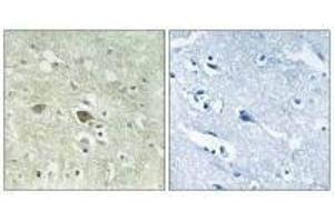 Immunohistochemistry analysis of paraffin-embedded human brain tissue using NDUFV3 antibody. (NDUFV3 抗体)
