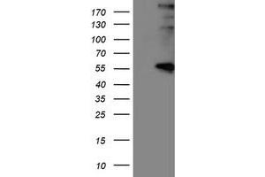 Western Blotting (WB) image for anti-Lysyl Oxidase (LOX) (AA 22-168) antibody (ABIN1491214)