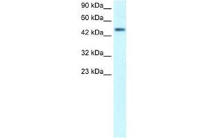 Human Lung; WB Suggested Anti-C5orf41 Antibody Titration: 0.