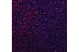 IF analysis of MFF using anti-MFF antibody (ABIN7599292). (MFF 抗体  (AA 1-342))