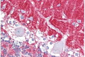 Immunohistochemistry (IHC) image for anti-Guanine Nucleotide Binding Protein (G Protein), alpha Activating Activity Polypeptide O (GNAO1) (AA 108-157) antibody (ABIN6748528)