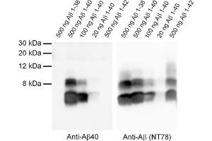 Detection of synthetic Abeta 1-38, 1-40 and 1-42 with anti-Abeta 40 (dilution 1 : 1000) and anti-Abeta (Cat. (Abeta 1-40 抗体  (AA 33-40))