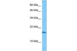 Host:  Mouse  Target Name:  GABARAP  Sample Tissue:  Mouse Skeletal Muscle  Antibody Dilution:  1ug/ml (GABARAP 抗体  (N-Term))