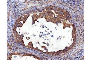 IHC analysis of RRS1 using anti-RRS1 antibody (ABIN7602918). (RRS1 抗体  (C-Term))