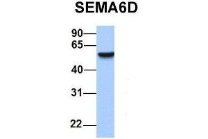 Western Blotting (WB) image for anti-Sema Domain, Transmembrane Domain (TM), and Cytoplasmic Domain, (Semaphorin) 6D (SEMA6D) (N-Term) antibody (ABIN2783810)
