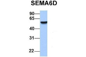 Host:  Rabbit  Target Name:  SEMA6D  Sample Type:  Human Adult Placenta  Antibody Dilution:  1. (SEMA6D 抗体  (N-Term))