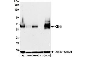 Western Blotting (WB) image for anti-CD48 (CD48) (AA 29-220) antibody (ABIN7795687) (Recombinant CD48 抗体  (AA 29-220))