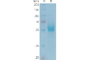 Human CD161 Protein, hFc Tag on SDS-PAGE under reducing condition.