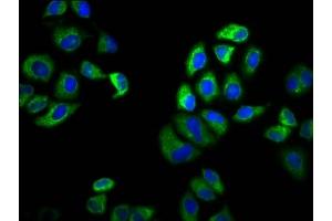 Immunofluorescence (IF) image for anti-Solute Carrier Family 6 (Neutral Amino Acid Transporter), Member 19 (SLC6A19) (AA 326-413) antibody (ABIN7169980)