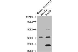 Western Blot Positive WB detected in: Mouse heart tissue, Mouse liver tissue, Mouse kidney tissue, Mouse brain tissue, Mouse skeletal muscle tissue, Mouse stomach tissue All lanes: MTND1 antibody at 3 μg/mL Secondary Goat polyclonal to rabbit IgG at 1/50000 dilution Predicted band size: 36 kDa Observed band size: 36 kDa (MT-ND1 抗体  (AA 23-67))