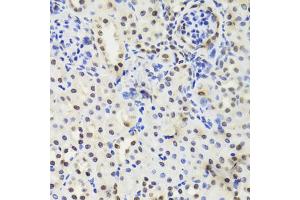 Immunohistochemistry of paraffin-embedded mouse kidney using EFTUD2 Antibody (ABIN5974236) at dilution of 1/100 (40x lens). (EFTUD2 抗体)