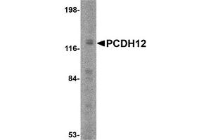 Western Blotting (WB) image for anti-Protocadherin 12 (PCDH12) (N-Term) antibody (ABIN1031505) (PCDH12 抗体  (N-Term))
