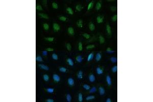 Immunofluorescence (IF) image for anti-Deoxyuridine Triphosphatase (DUT) (AA 89-252) antibody (ABIN7266736)