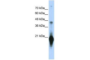 WB Suggested Anti-C17orf49 Antibody Titration: 0. (C17orf49 抗体  (Middle Region))