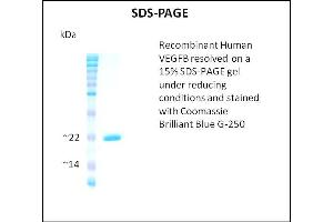 SDS-PAGE (SDS) image for Vascular Endothelial Growth Factor B (VEGFB) (Active) protein (ABIN5509799) (VEGFB 蛋白)