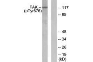 Western blot analysis of extracts from NIH-3T3 cells, using FAK (Phospho-Tyr576) Antibody. (FAK 抗体  (pTyr576))