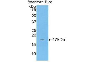 Western blot analysis of the recombinant protein. (Adrenomedullin 抗体  (AA 35-171))